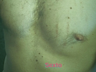 Sexto